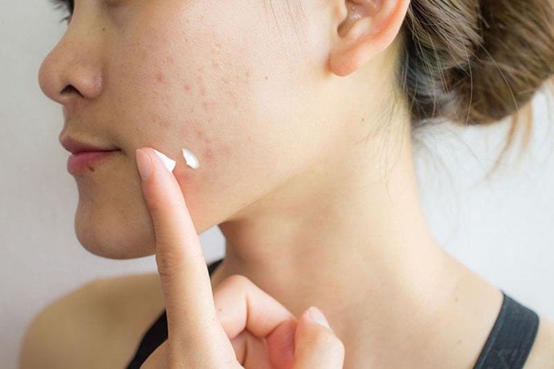 Đắp mặt nạ xong nên làm gì 2